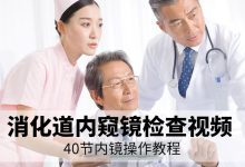 胃镜教程视频教程-做胃镜检查的全部过程是怎样的?-大智网汇