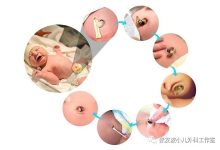 剪脐带教程详细教程-怀孕过程-大智网汇
