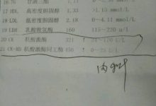 肌酸激酶高是怎么回事-肌酸激酶高是什么原因引起的-大智网汇