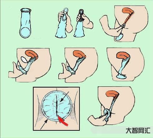 怎么使用避孕套