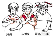 冠心病的症状表现在哪些方面-冠心病有什么特征症状?-大智网汇
