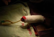 怎么目测阴茎勃起的长度-男生生殖器标准长度是多少,怎么测量?-大智网汇