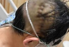 网曝河南 59 岁医生上班期间被捅数刀,院方称「确有此事」,哪些信息需关注?如何有效保障医护人员安全?-大智网汇