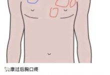 感染潮下,年轻人涌入 CT 室和互联网问诊,体现了什么心态?年经人在担忧什么?-大智网汇
