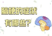 脑梗的症状都有哪些前期症状-脑梗的前兆有哪些-大智网汇
