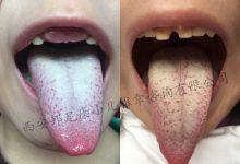 舌头上有白苔是什么原因-舌苔白是怎么回事?-大智网汇