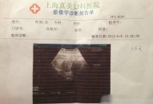 怀孕一个月怎么打掉最安全-怀孕一个月内怎么打胎-大智网汇