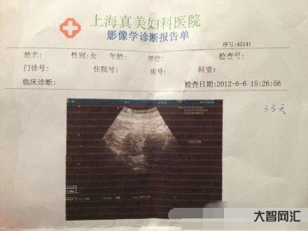 1、怀孕一个月内如何打胎?