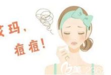 怎么样去痘-怎么样才能有效快速的祛痘-大智网汇