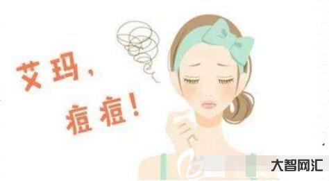 2、如何快速消除痤疮?