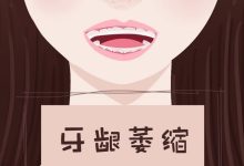 牙龈萎缩怎么恢复-牙龈萎缩可以恢复吗?吃什么药会很快恢复?谢谢-大智网汇