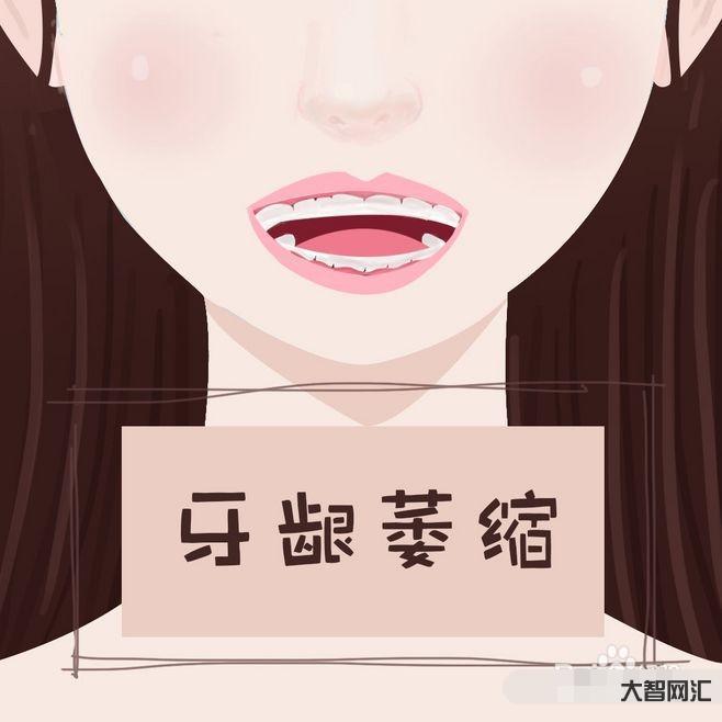 2、如何修复牙龈萎缩?