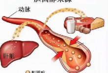 总胆固醇高说明什么-总胆固醇偏高是咋回事儿?-大智网汇