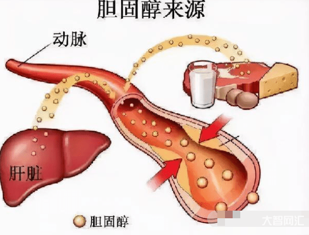 2、高胆固醇怎么了?