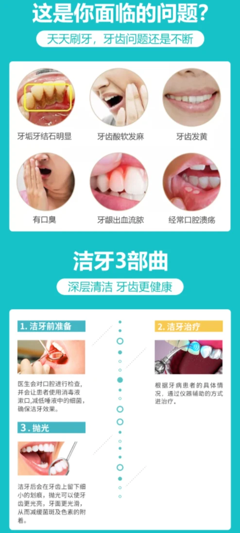 2、洗一次牙要多少钱?洗一次要多长时间?