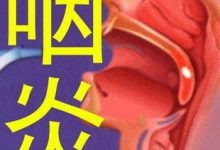 咽炎的症状有哪些症状-患上咽喉炎后,身体都会有什么症状?-大智网汇