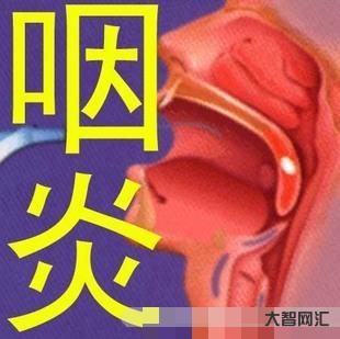 1、患咽喉炎后,身体会有什么症状?