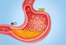 胃在什么位置图片-胃在什么位置?-大智网汇