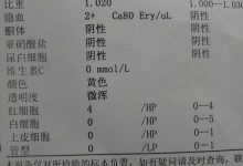 尿蛋白高是怎么回事-请问尿蛋白高是什么原因?-大智网汇