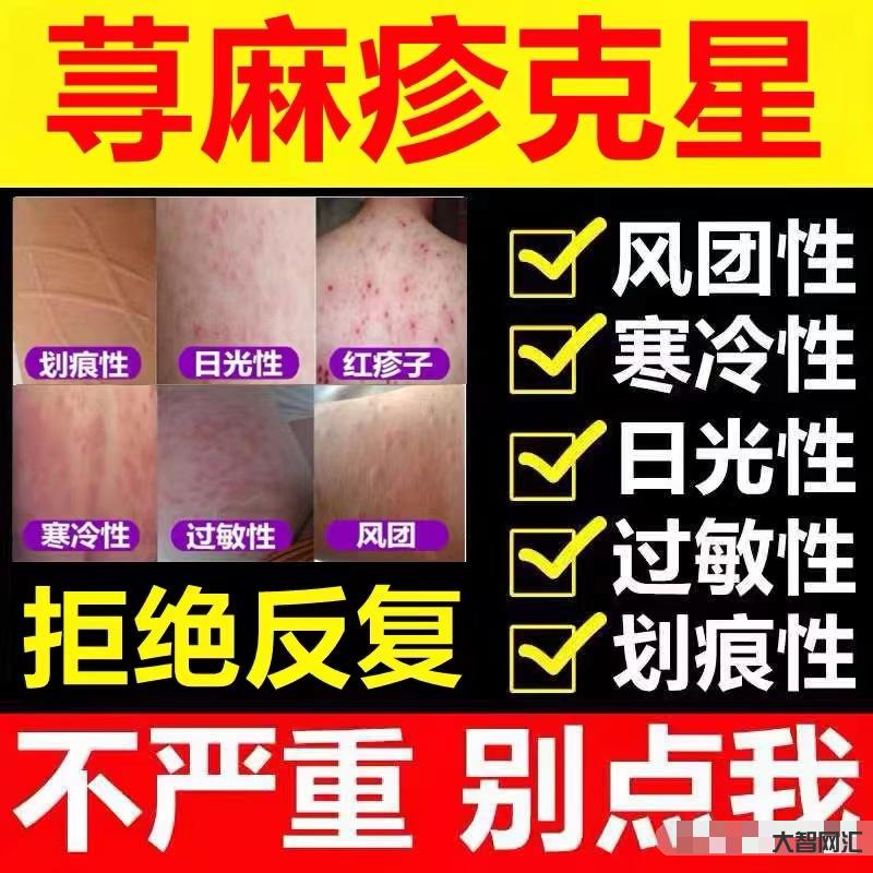 1、如何治疗荨麻疹?