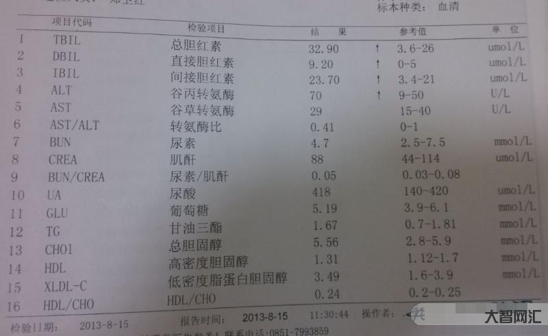 1、高胆红素的原因和危害