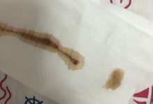 月经量少颜色黑褐色是什么原因-月经量少而黑是什么原因引起的-大智网汇