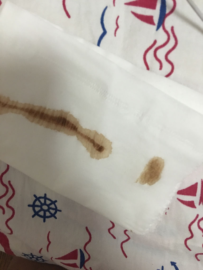1、月经量少而黑的原因是什么?