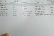 间接胆红素偏高是什么意思-胆红素高是怎么回事 是什么原因引起的-大智网汇