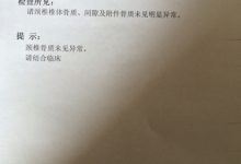 dr检查是什么意思-CT和DR的区别-大智网汇