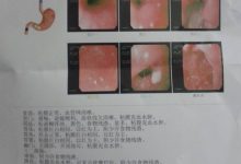 胃炎的症状有哪些-胃病的症状表现有哪些-大智网汇