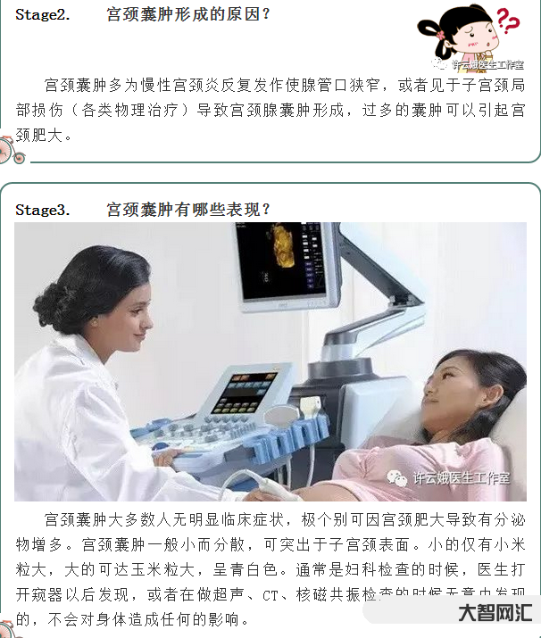 2、多发性囊肿怎么办?