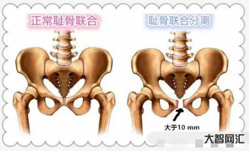 耻骨是哪个部位-武术中的胯到底指的是身体的哪个部位?他在武术中到底有什-大智网汇