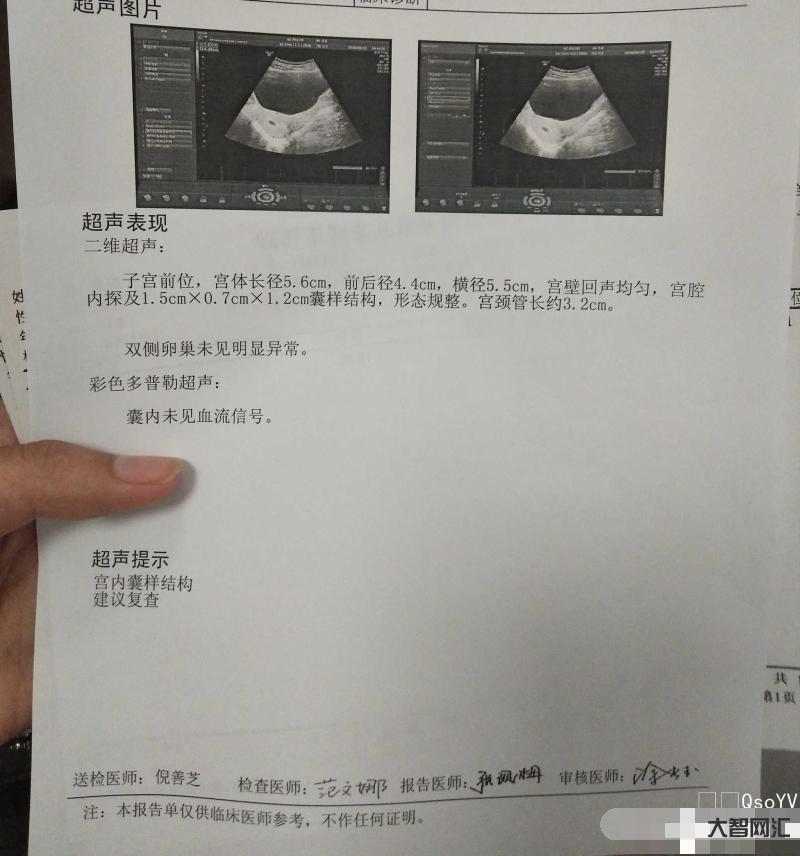 宝宝没有动胎心正常嘛怎么办-很多的孕妈被告知宝宝没有胎心,往往与这些原 宝宝没有动胎心正常嘛怎么办-很多的孕妈被告知宝宝没有胎心,往往与这些原