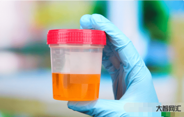 血脂跟血肌酐一样吗-血肌酐高了不要怕,这5个指标尚可的肾病也可以与尿毒 血脂跟血肌酐一样吗-血肌酐高了不要怕,这5个指标尚可的肾病也可以与尿毒