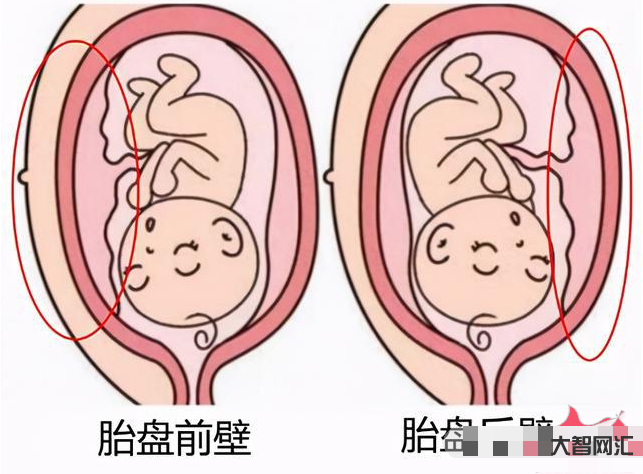 有胎盘了一般是几周生-生与熟 胎盘几级暗示妈妈就要生啦? 有胎盘了一般是几周生-生与熟 胎盘几级暗示妈妈就要生啦?