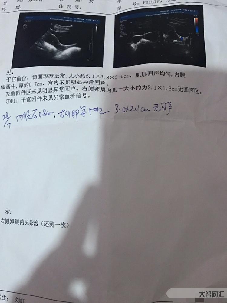 2、子宫内膜多厚正常