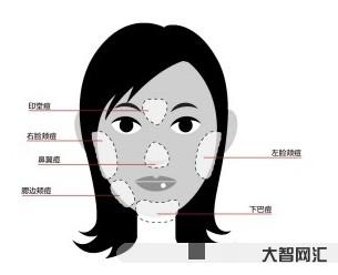 下巴长痘痘是什么原因-下巴长痘的原因及调理方法-大智网汇