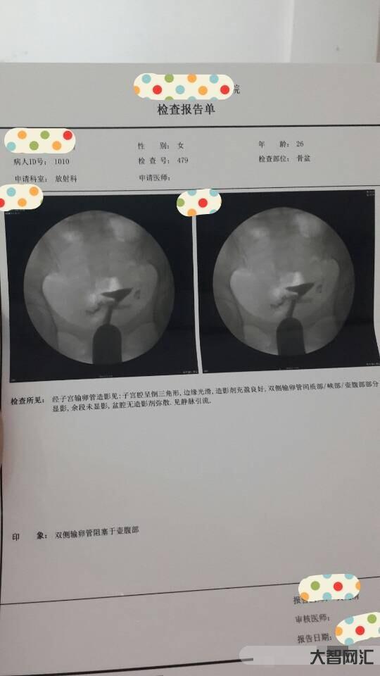输卵管堵塞有什么样症状-做输卵管造影很疼吗?危害大吗?-大智网汇