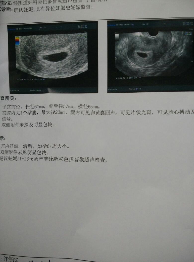 宝宝没有动胎心正常嘛怎么办-很多的孕妈被告知宝宝没有胎心,往往与这些原-大智网汇