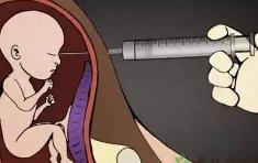怀孕一个月怎么打掉最安全?打完有什么主意事项-大智网汇