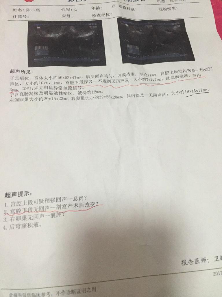 积水多久能排干净啊-广东韶关多镇出现强降雨,有村里积水深达1米,转移上 积水多久能排干净啊-广东韶关多镇出现强降雨,有村里积水深达1米,转移上
