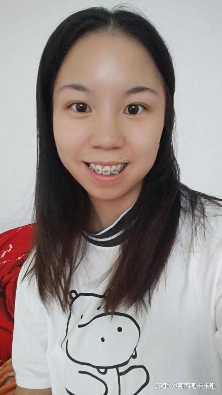 有一副牙套只戴了五天-疫情时牙套遇到突发情况怎么办?应对办法在这里-大智网汇