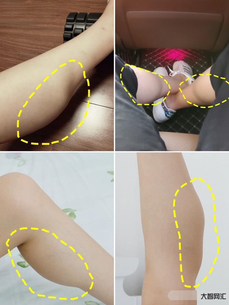 为什么腿的肌肉好紧绷绷的-我是因为胯大才腿粗?今天才知道减掉粗大腿得先-大智网汇