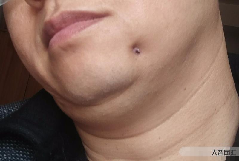 下巴上突然有凹陷-面中部凹陷、下巴很长,像朱元璋这种“猪腰子脸”还能拯 下巴上突然有凹陷-面中部凹陷、下巴很长,像朱元璋这种“猪腰子脸”还能拯