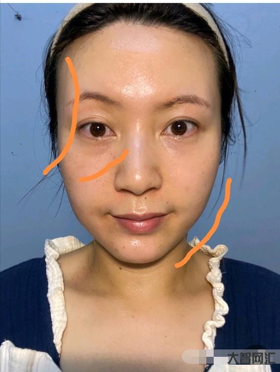 下巴上突然有凹陷-面中部凹陷、下巴很长,像朱元璋这种“猪腰子脸”还能拯 下巴上突然有凹陷-面中部凹陷、下巴很长,像朱元璋这种“猪腰子脸”还能拯