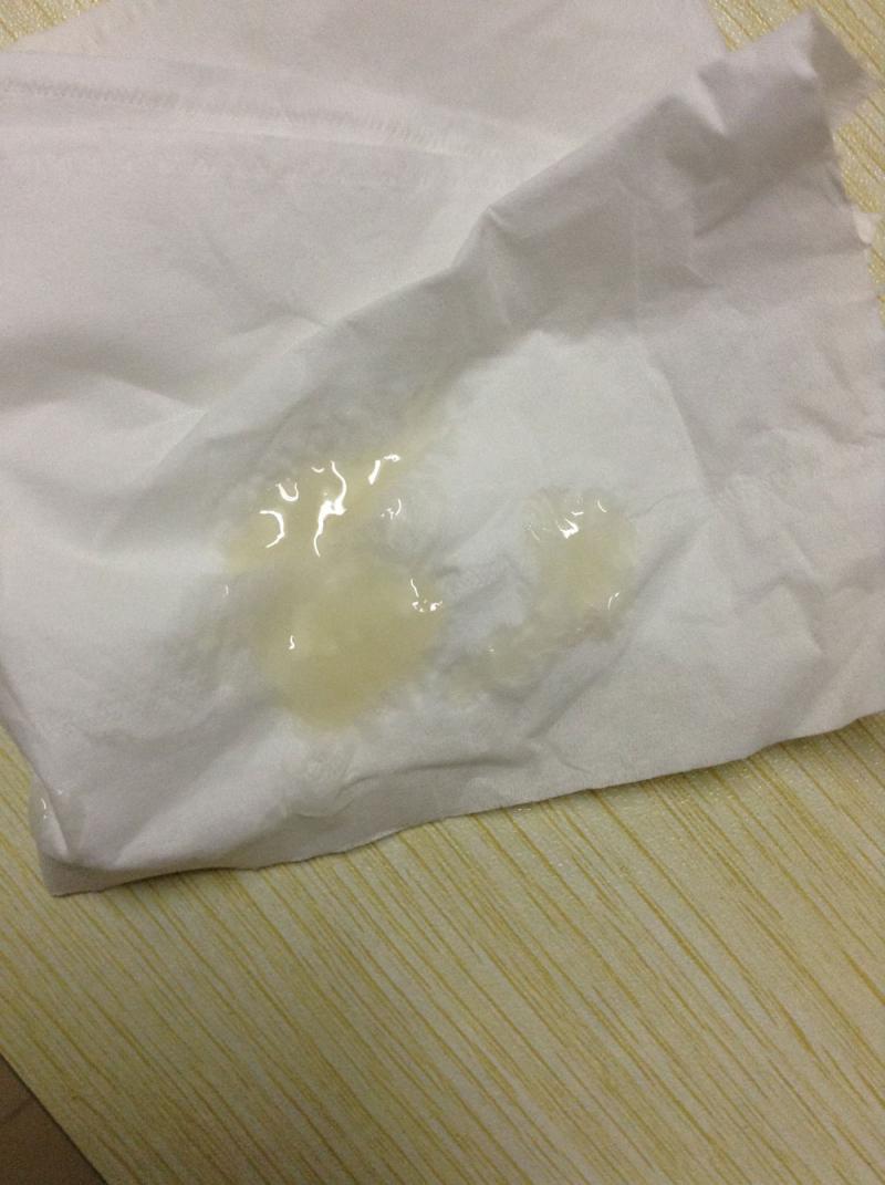 遗精颜色是黄的-每个月遗精几次会对身体有害吗?避免4种方式,科学用药治 遗精颜色是黄的-每个月遗精几次会对身体有害吗?避免4种方式,科学用药治