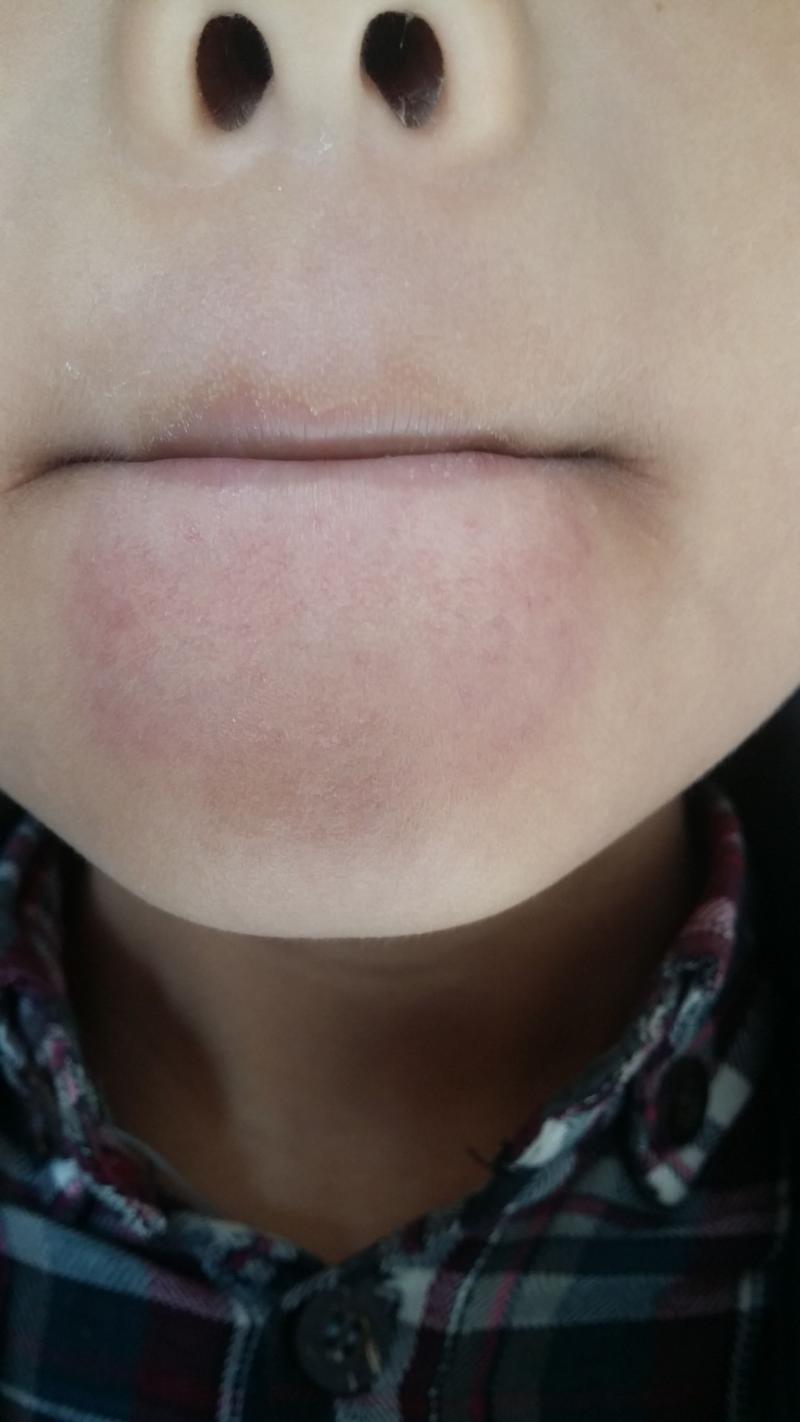 下巴上突然有凹陷-面中部凹陷、下巴很长,像朱元璋这种“猪腰子脸”还能拯 下巴上突然有凹陷-面中部凹陷、下巴很长,像朱元璋这种“猪腰子脸”还能拯