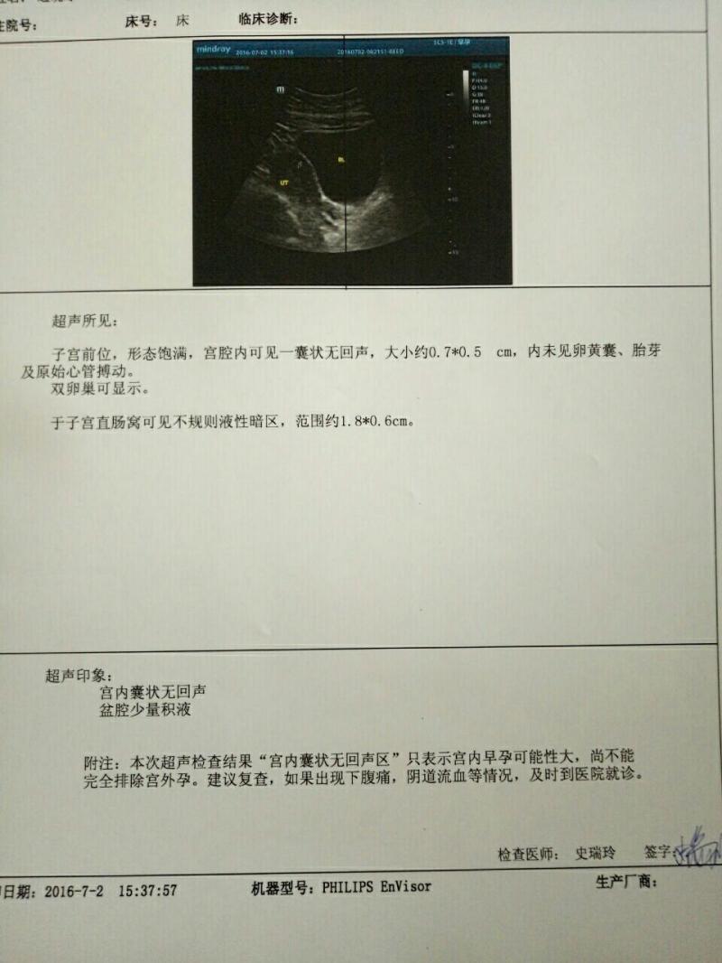 宫外孕再次怀孕会胎停吗-为什么越来越多人怀不上孩子?它才是生育能力最大 宫外孕再次怀孕会胎停吗-为什么越来越多人怀不上孩子?它才是生育能力最大
