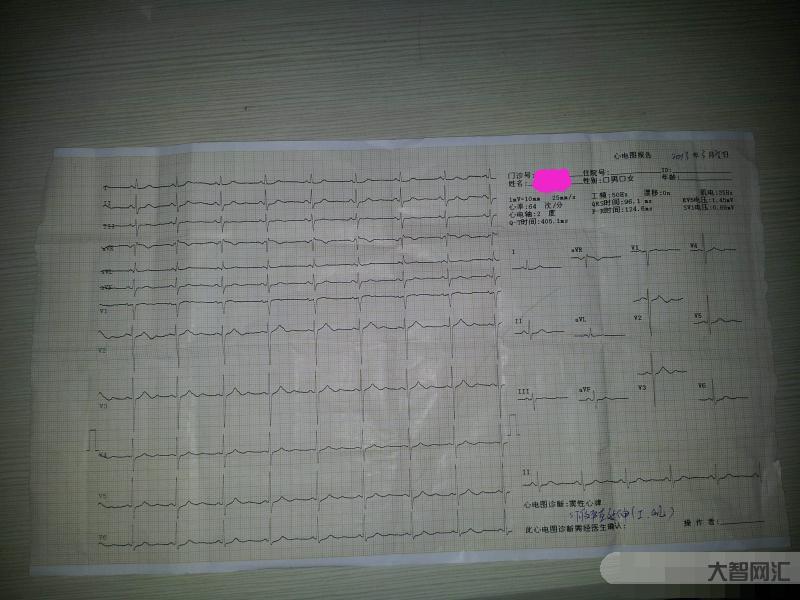 窦性心律什么意思-体检报告里面的“窦性心律”,是什么意思,是正常的现象-大智网汇