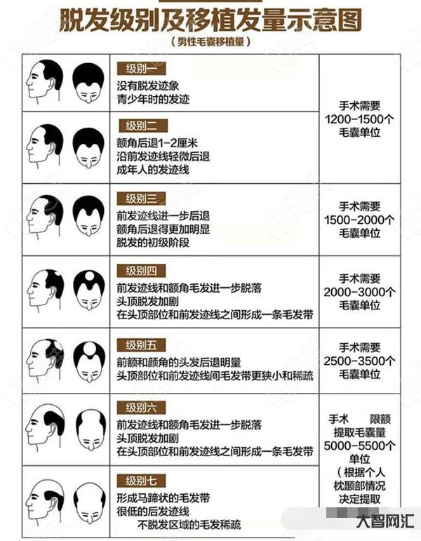 植发要多少钱一般-印度男子植发,把命搭进去?为一头秀发,穷人只能去黑诊-大智网汇